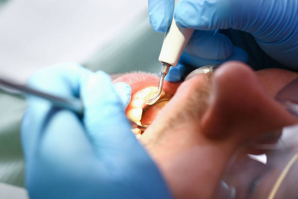 Best Emergency Treatment for Toothache in Sapulpa, OK