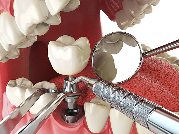 Best Emergency Root Canal Treatment in Sapulpa, OK